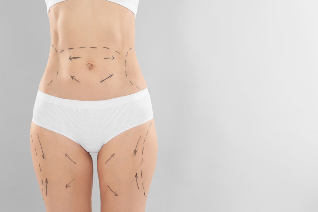 Woman with marks on body for cosmetic surgery operation against grey background, closeup Woman with marks on body for cosmetic surgery operation against grey background, closeup
